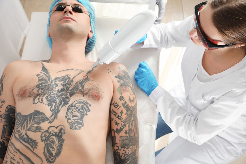 Man undergoing laser tattoo removal procedure in salon