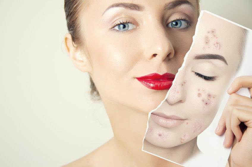 young woman face portrait with photo of her old skin